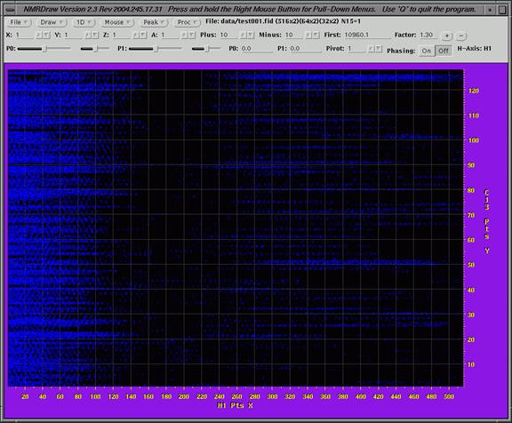 nmr image