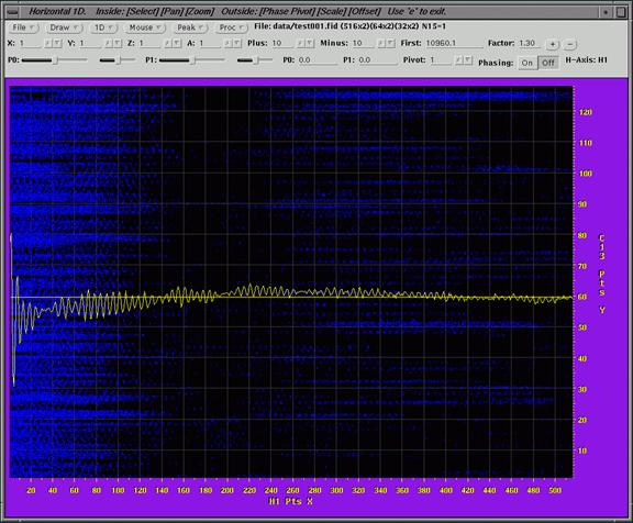 nmr image