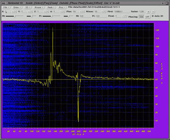 nmr image