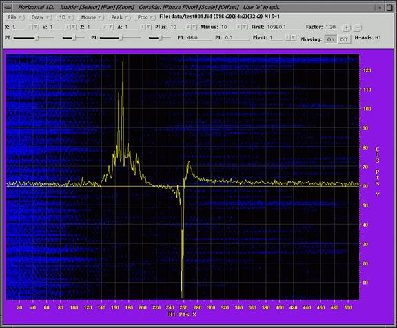 nmr image