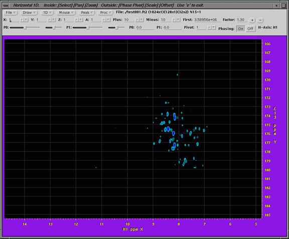 nmr image