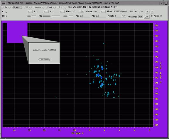 nmr image