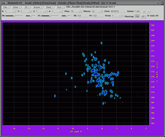 nmr image