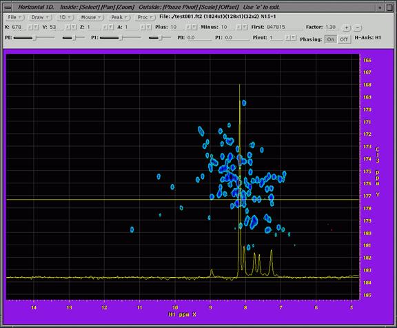 nmr image