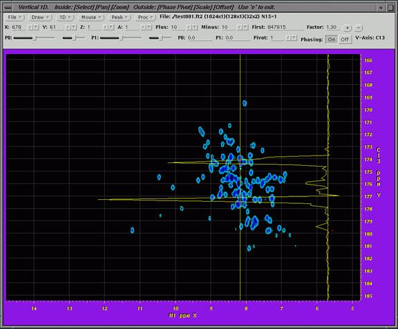 nmr image