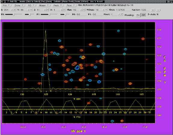 nmr image